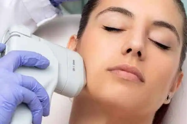 Image of woman having HIFU Reigate treatment