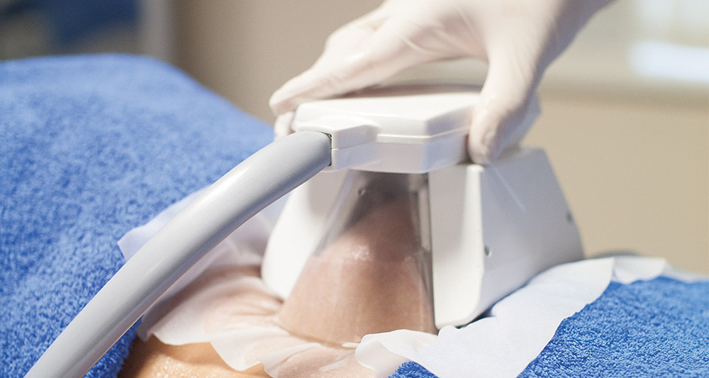 How Fat Freezing and HIFU Work Together? 2 Multiple Areas in One Session HIFU and Fat Freezing Reigate
