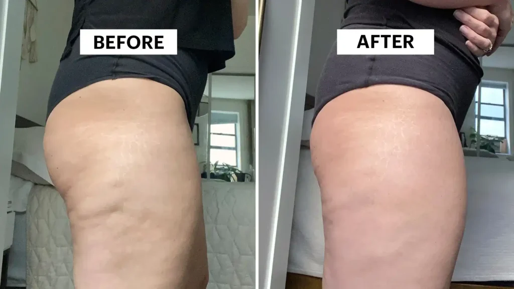 Do Toning Exercise Reigate Really Tackle Cellulite?
